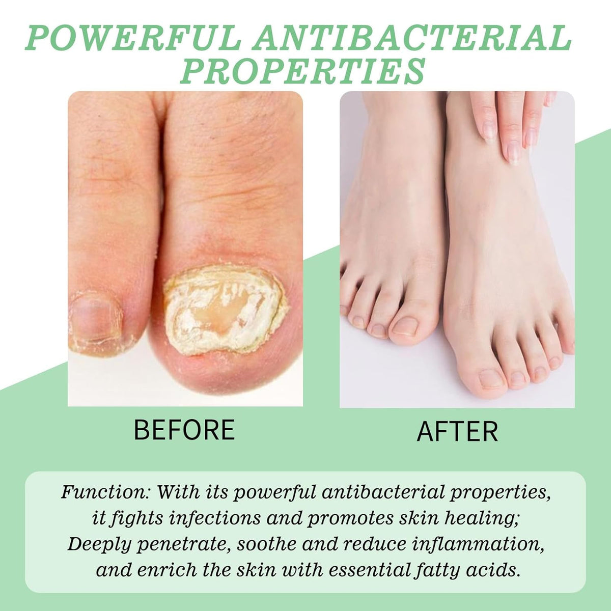 Nutraboost Nail Treatment, Nail Growth Serum for Repair & Strengthener,Multi-Purpose Nail Repair Oil Serum (1)