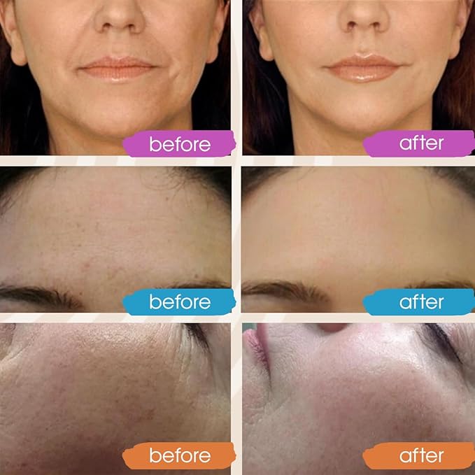 GLEOW Retinol Serum for Face with Hyaluronic Acid, Retinol for Face Is Suitable for All Skin Types, Hydrating Serum Women and Men Plumps Youthful Appearance 2oz