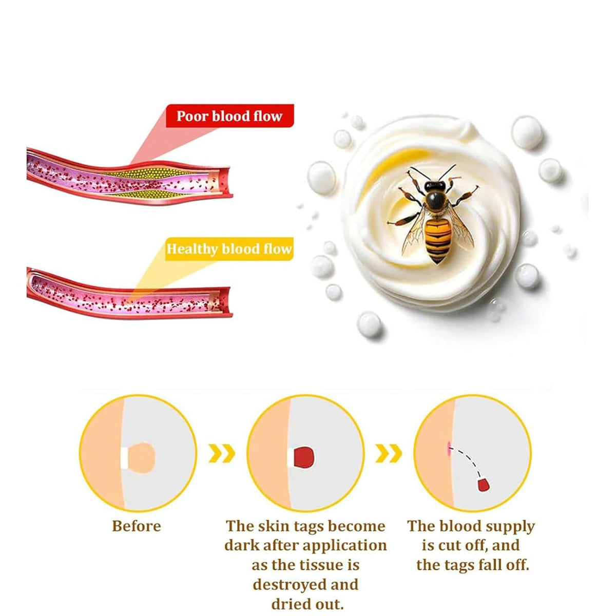 Bee Venom Skin Treatment Cream, Bee Venom Repair Cream, Suitable for All Skin Types