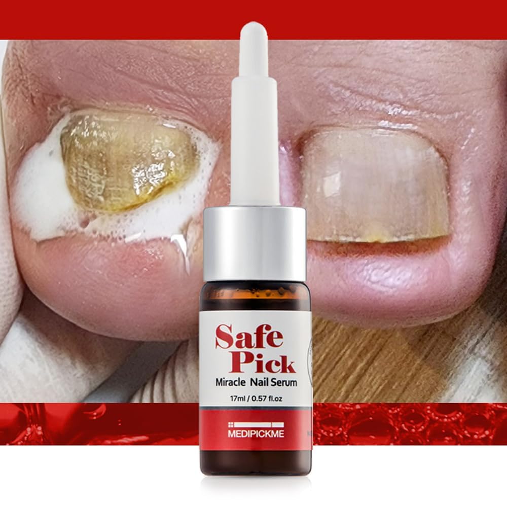 Safepick Miracle Nail Serum Nail Strengthener | Clear & Opaque Crème Nail Polish Treatment | Strengthen Weak & Thin Nails