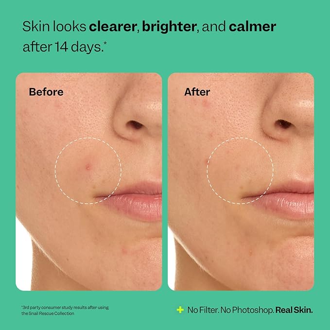 Peach Slices - Snail Rescue Purifying Cleanser (4.05 oz) - Snail Mucin Concentrate - Cleanse & Refresh Skin - Pine Bark, Hyaluronic Acid & Cica - Vegan & Cruelty Free - Korean Skin Care & Beauty
