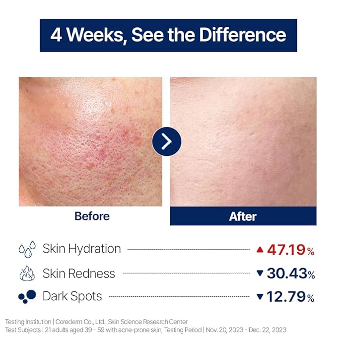 CELORABY 4GF Derma Repair Hydro Serum - Hydrating Serum with Quadruple Peptides, Niacinamide, and Hyaluronic Acid for Smooth, Healthy-Looking Skin (1.01 fl. oz)