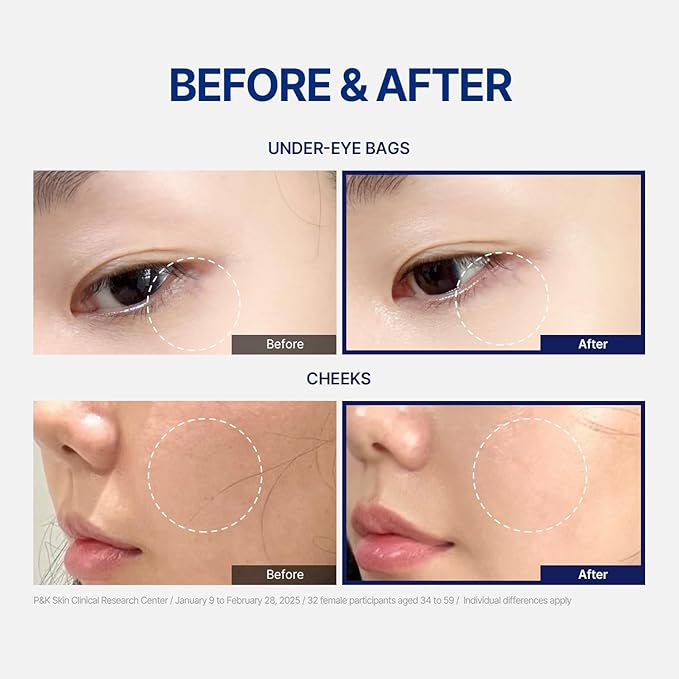 Wrinkle Spot Treatment Serum - Korean Skincare Anti-Wrinkle Brightening Serum with Peptides and Fermented Extracts for Glass Skin, Radiance & Hydration Support (15ml / 0.5 fl. oz)