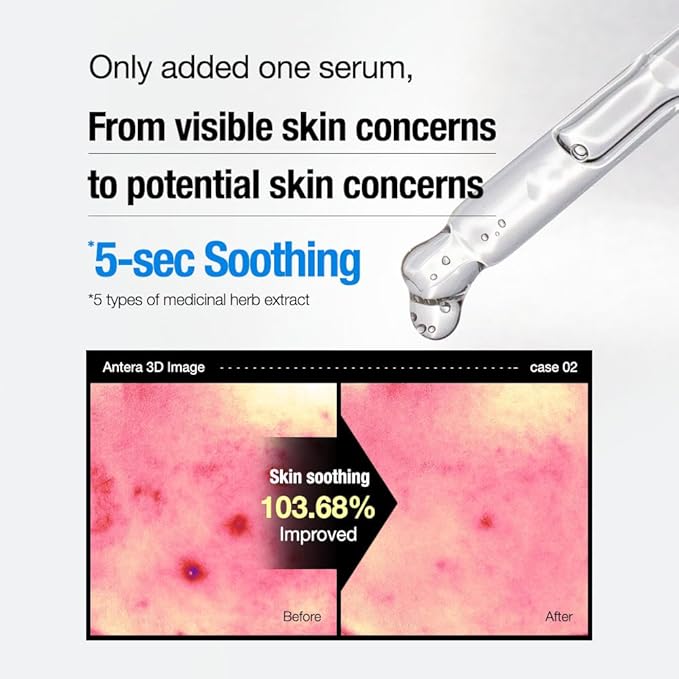 PHYTO CALM SERUM, Blemish Care, Hydration & Soothing Serum, Supports Skin Barrier, Soothes Skin Irritation, Supports Clear Skin, 1.01fl.oz/30ml