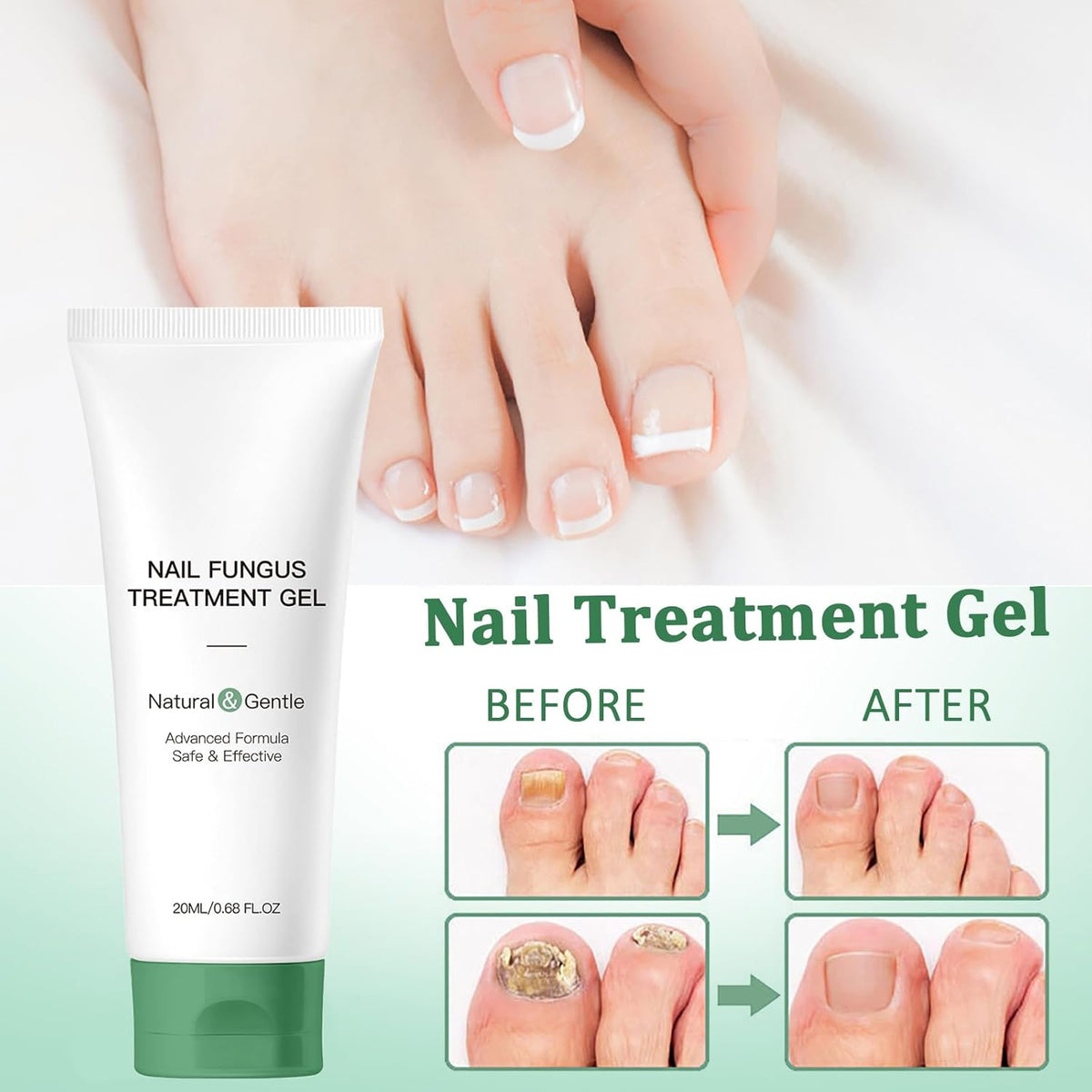Nutraboost Nail Treatment Gel, Nail Growth Serum for Repair & Strengthener, Multi-Purpose Nail Repair Serum (2)