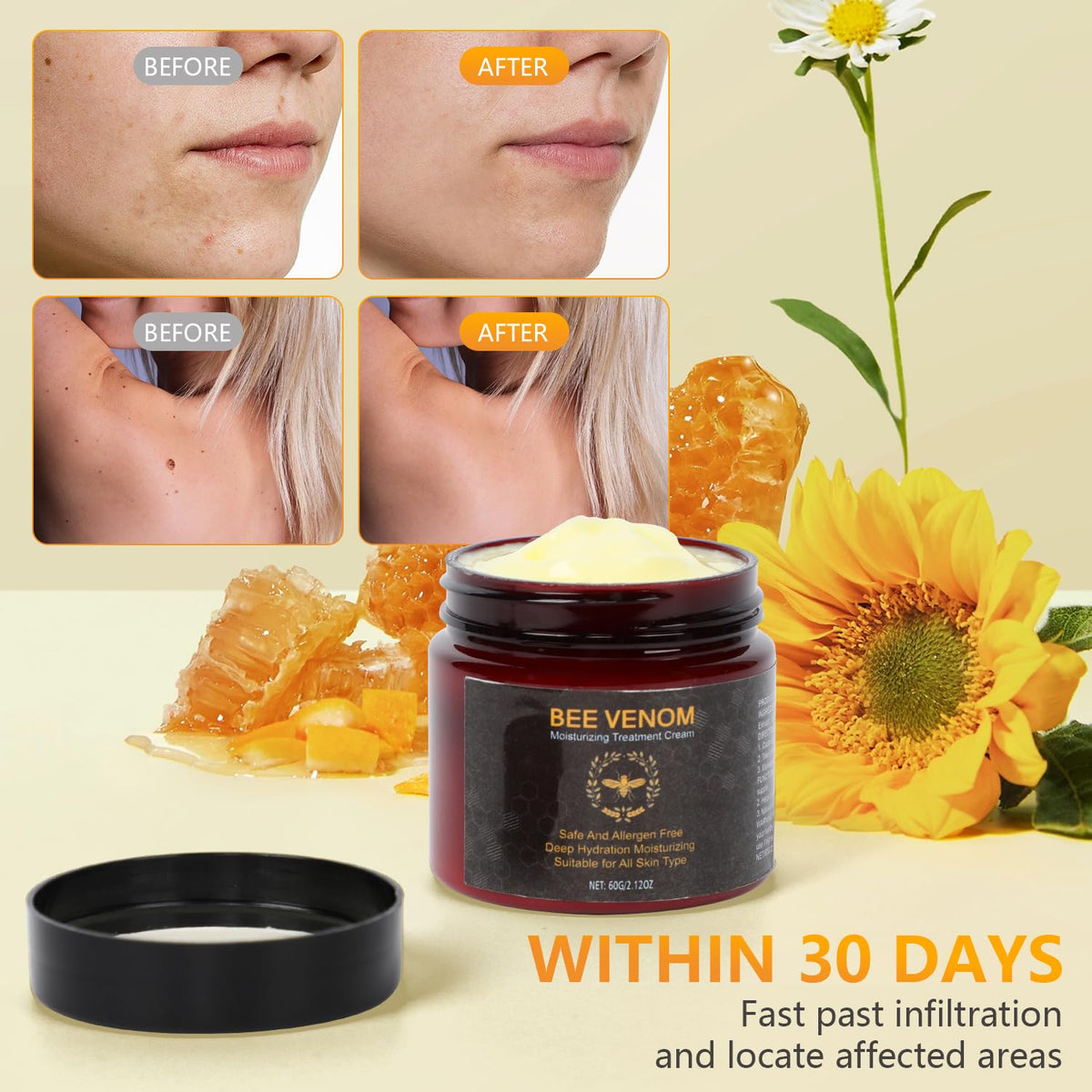 2 PCS Bee Venom Cream, 2025 New Bee Venom Skin Repair Cream for All Skin Types