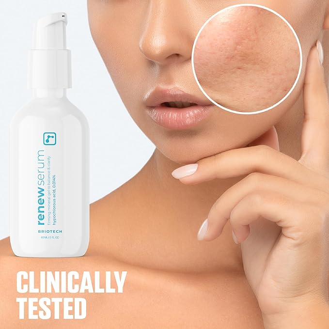 BRIOTECH Renew Serum, Hypochlorous Acid Mineral Gel, Soften Fine Line Appearance, Smooth Skin for Face, Neck, Chest, Spot Corrector, Soothe Redness, Vegan, 2 fl oz (4 Pack)