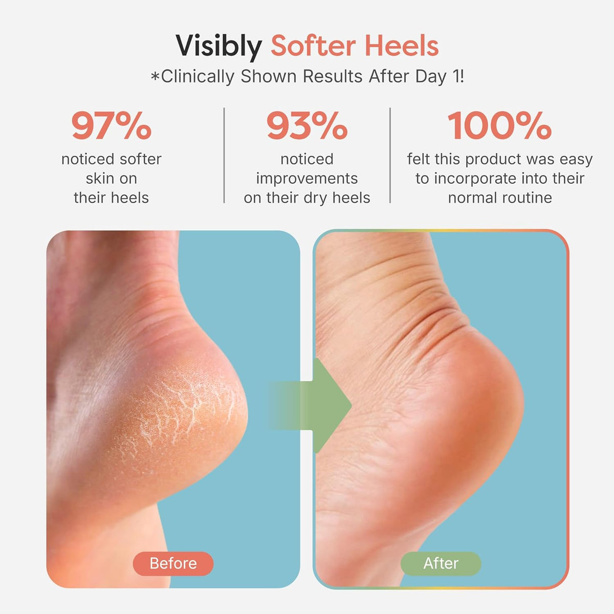 ZenToes Moisturizing Fuzzy Sleep Socks with Vitamin E, Olive Oil and Jojoba Seed Oil to Soften and Hydrate Dry Cracked Heels (Regular, Slate)2 Pair (Pack of 1)