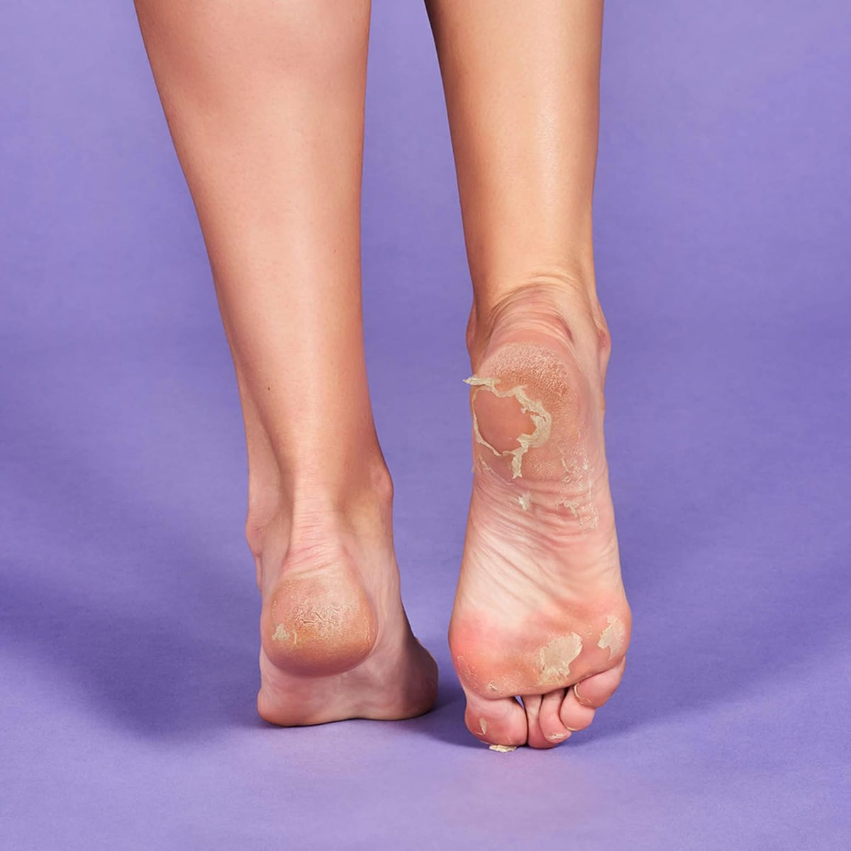 IROHA NATURE Exfoliating Foot Peeling Socks | 1 Pair (1 Use) | With Glycolic, Lactic, Salicylic Acids & Lavender | Intensive Treatment for Callused, Dry & Cracked Feet | Vegan Formula