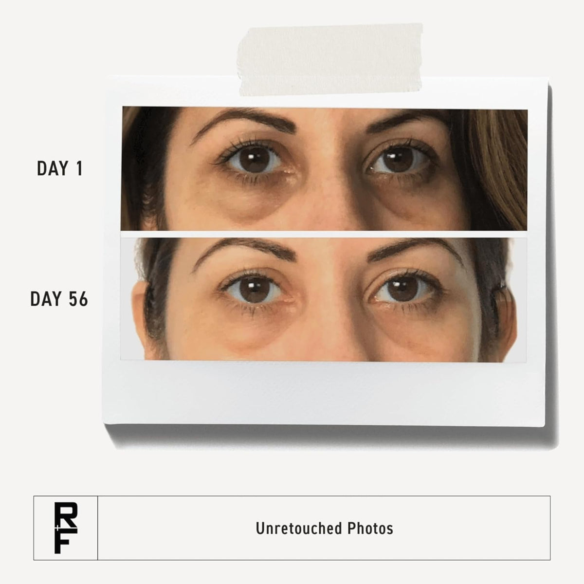 RODAN + FIELDS Active Hydration Bright Eye Complex | 15ml | Moisturizing Under Eye Cream for Dry Skin | Eye Treatment for Refreshed Appearance | Skincare