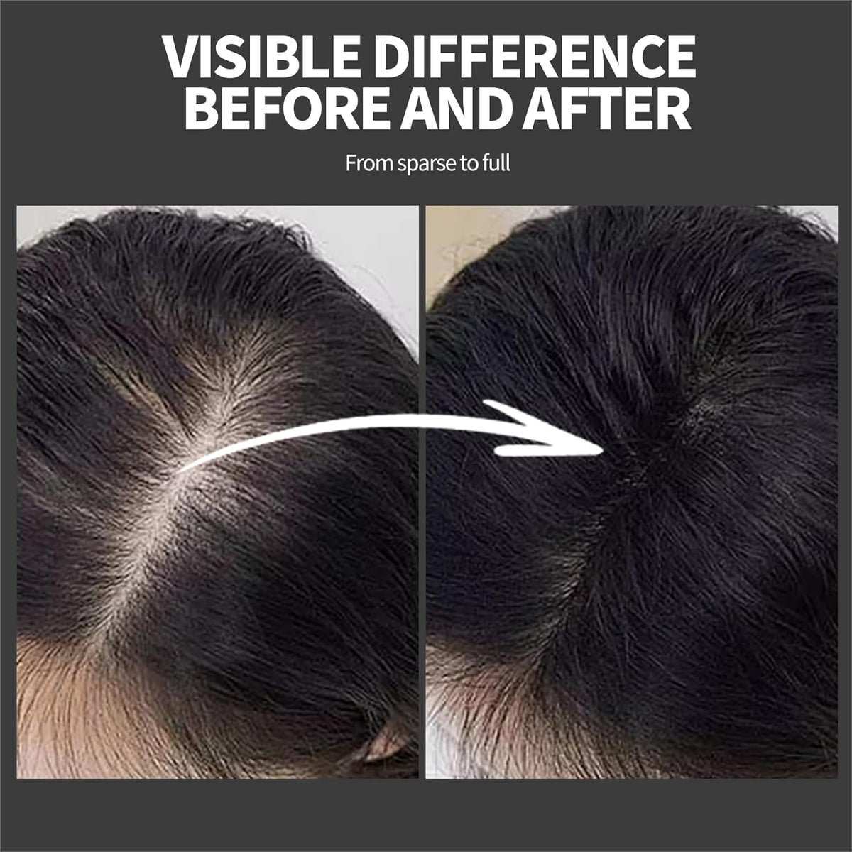 Hair Building Fibers 25G with Precision Spray Applicator - Electrostatic Adsorption for Instant Thicker Hair, Waterproof & Natural Look, Suitable for Men & Women (Dark brown)