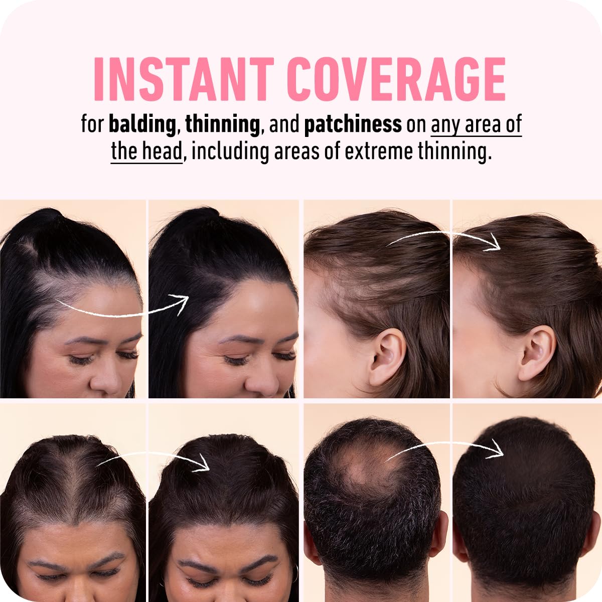 BOLDIFY Hairline Powder (LARGE, 10g) - Root Touch Up Hair Color for Gray Coverage - Bald Spot Concealing Hair Powder for Women & Men - 48-Hour Stain-Proof - Ash Brown