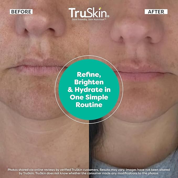 TruSkin Face Serum Trio – Hyaluronic Acid, Vitamin C & Retinol Serum for Face – Anti Aging Skin Care Set for Women – Skincare for Bright, Smooth, Hydrated & Firmer-Looking Skin, 1 fl oz, 3 Bottles