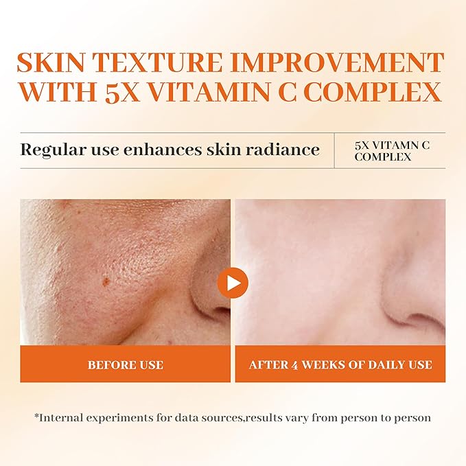 Vitamin C Skincare Kit - 2x Toners & 1x Serum with Niacinamide + Hyaluronic Acid | Hydration Prep,Skin Texture Support | Viral Trio Set , Unique Gift for Women