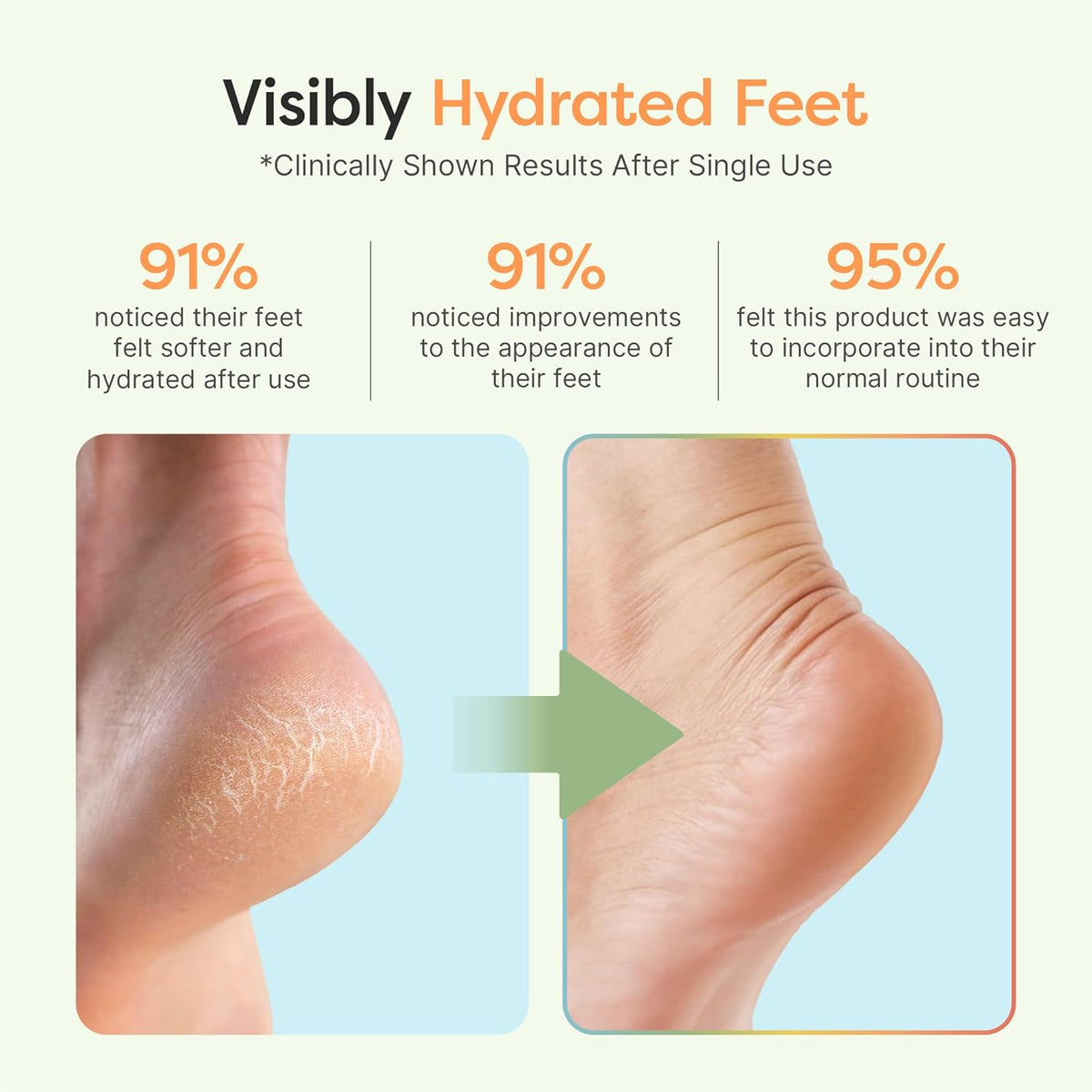 ZenToes Moisturizing Socks for Cracked Heel Treatment - Vitamin E, Olive Oil and Jojoba Oil Infused Heel Socks to Soften and Hydrate (Blue & White Stripes, Regular)