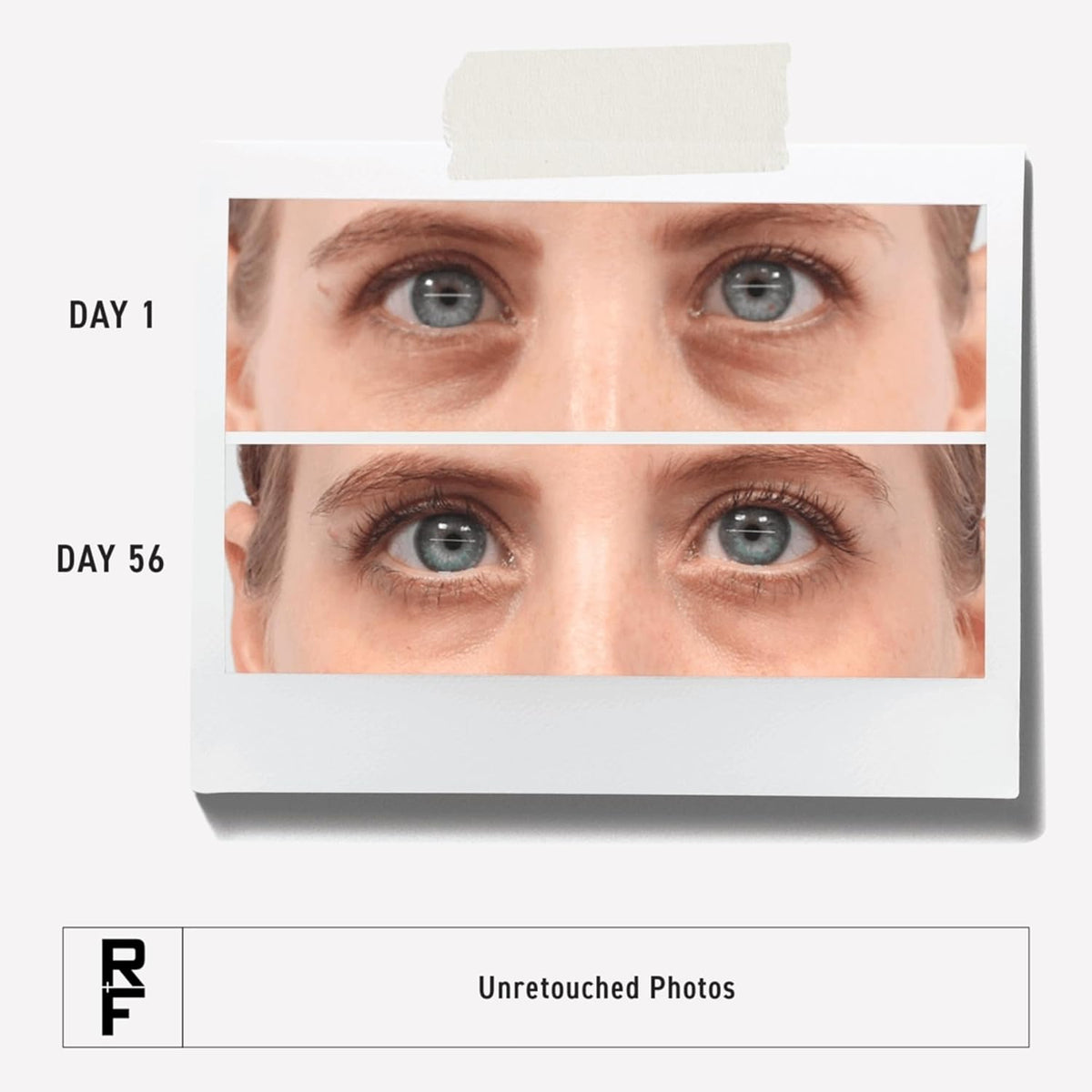 RODAN + FIELDS Active Hydration Bright Eye Complex | 15ml | Moisturizing Under Eye Cream for Dry Skin | Eye Treatment for Refreshed Appearance | Skincare