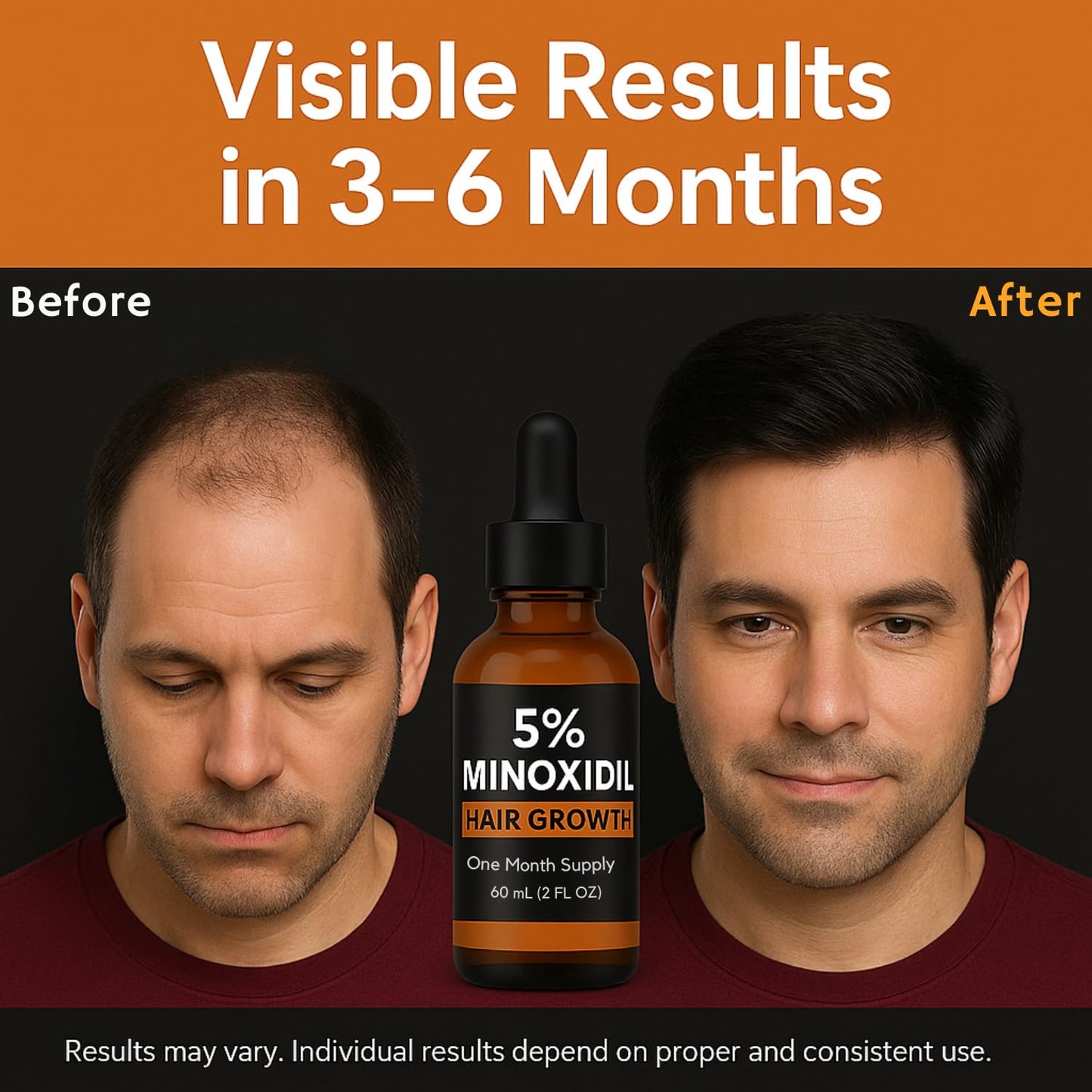 Minoxidil for Men 5% Topical Solution – Beard & Hair Regrowth Treatment, Extra Strength Hair Loss Formula for Thicker, Fuller Hair, Hair Growth Serum for Men