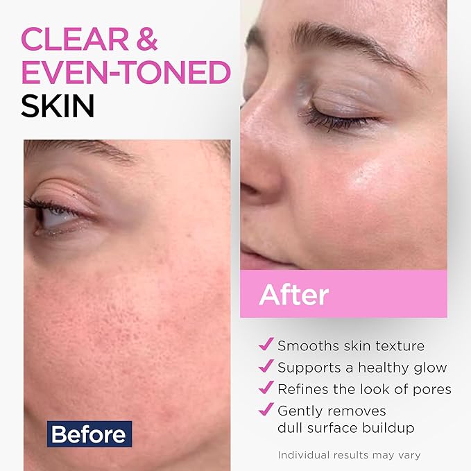 Glycolic Acid Serum for Face 15% - Extra Large Size (8 Oz) - Advanced Formula to Support Skin Radiance, Addressing Uneven Tone & Fine Lines