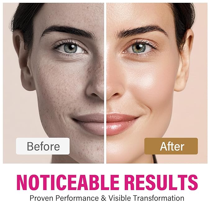 Hemir 8% Arbutin & 5% Tranexamic Acid Cream - Brightening Face Cream for Dark Spots & Hyperpigmentation, Melasma Treatment with Alpha Arbutin, Moisturizing & Even Skin Tone
