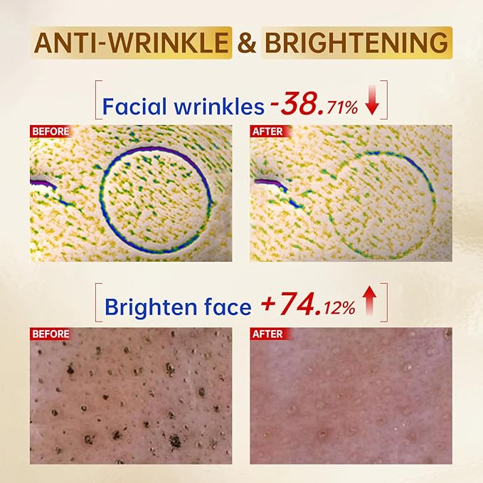 Vitamin C Face Serum with Vitamin C, Hyaluronic Acid, Vitamin E, Serum for Dullness, Balanced Complexion, Eye Area, Fine Lines & Wrinkles, 30ml/1.01oz