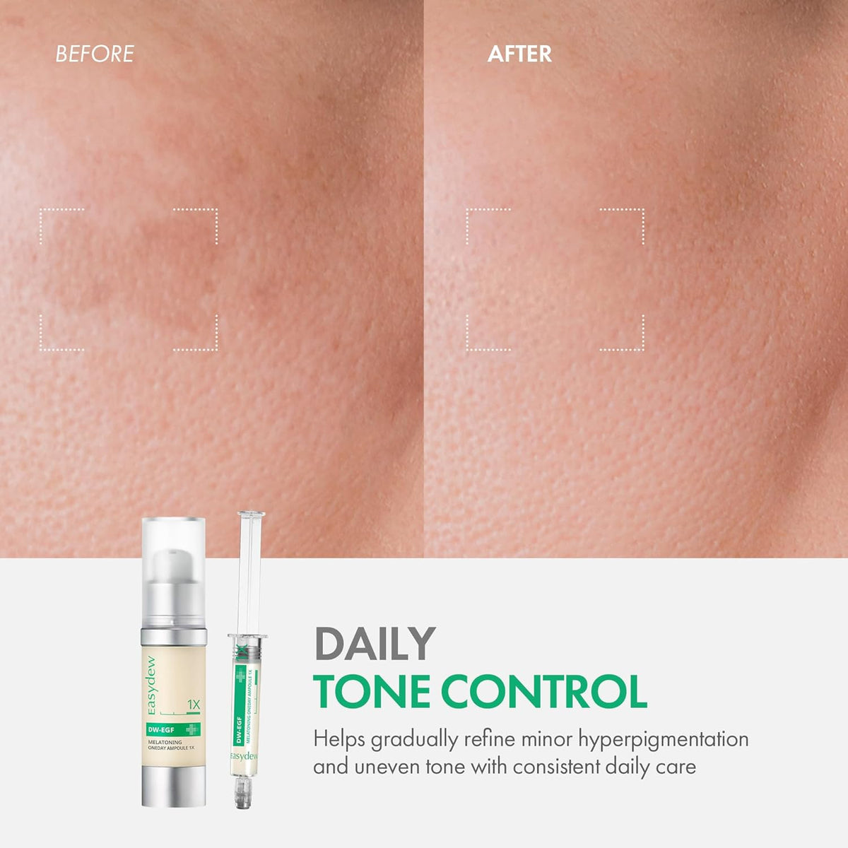Easydew DW-EGF Melatoning Ampoule 1X - Hydrating Dark Spot Serum with Niacinamide & Glutathione for Uneven Skin - Fast Absorbing Day & Night Ampoule Korean Skin Care (Pump 0.27 fl oz, EGF 1X)