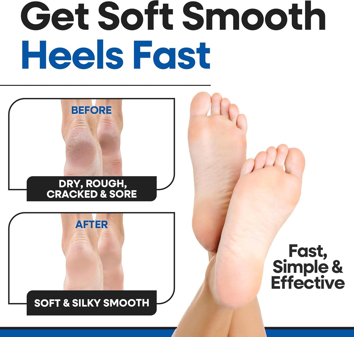 Moisturizing Socks for Men | Cracked Heel Treatment with Aloe Vera | Moisturizer Foot Callus Remover | Aloe Socks for Cracked Heels & Dry Cracked Feet | Lotion Infused Gel Heel Socks (Large - 3 Pairs)