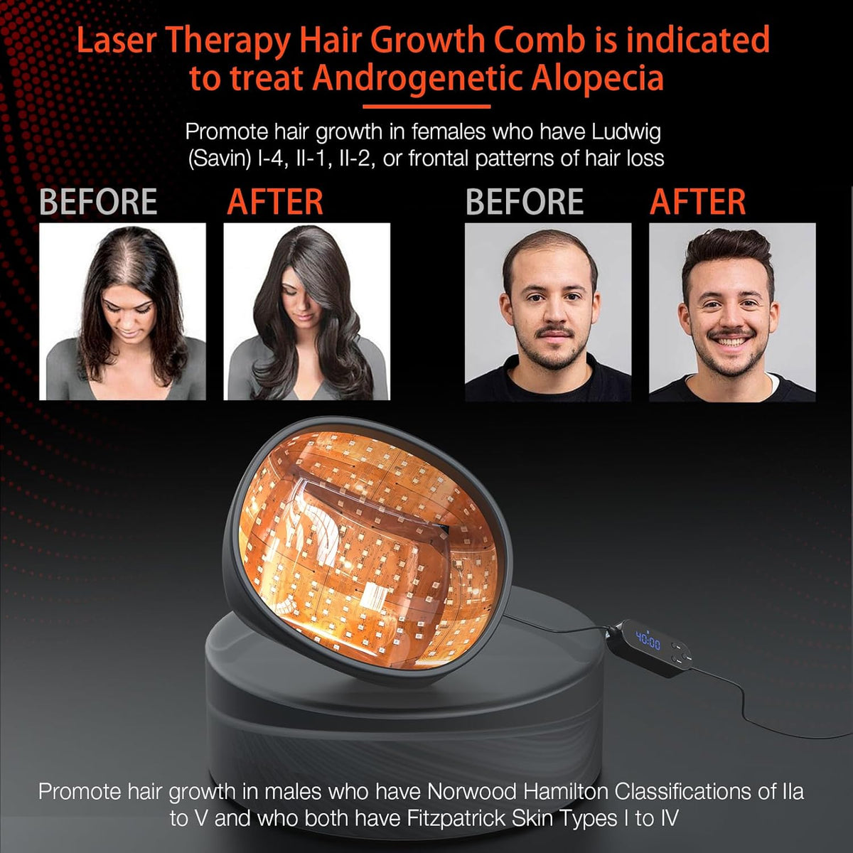 Laser Cap (FDA Cleared), Professional Medical Grade Lasers Hair Growth Treatment Product for Men & Women, Red Light Therapy for Hair Growth, Treat Alopecia