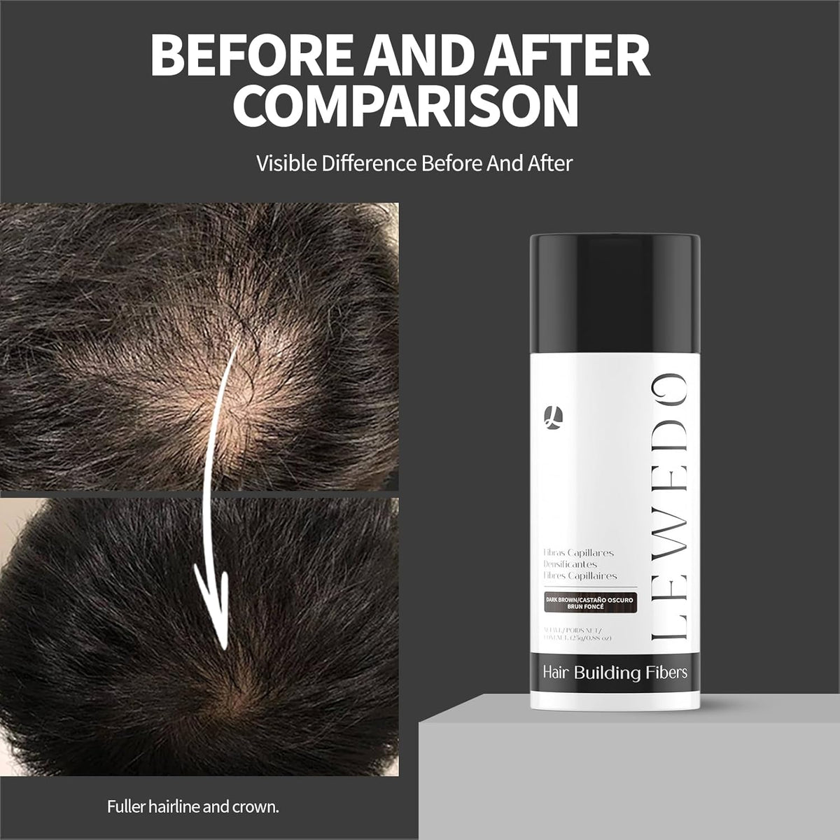 Hair Building Fibers 25G with Precision Spray Applicator - Electrostatic Adsorption for Instant Thicker Hair, Waterproof & Natural Look, Suitable for Men & Women (Black)