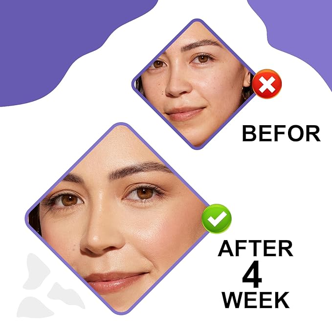 Retinol & Hyaluronic Acid Night Cream, Anti-Aging Face Moisturizer，Anti-Aging Retinol Face Cream for Women, Firms Skin to Fight Fine Lines, Wrinkles & Dark Spots, 1.7 oz