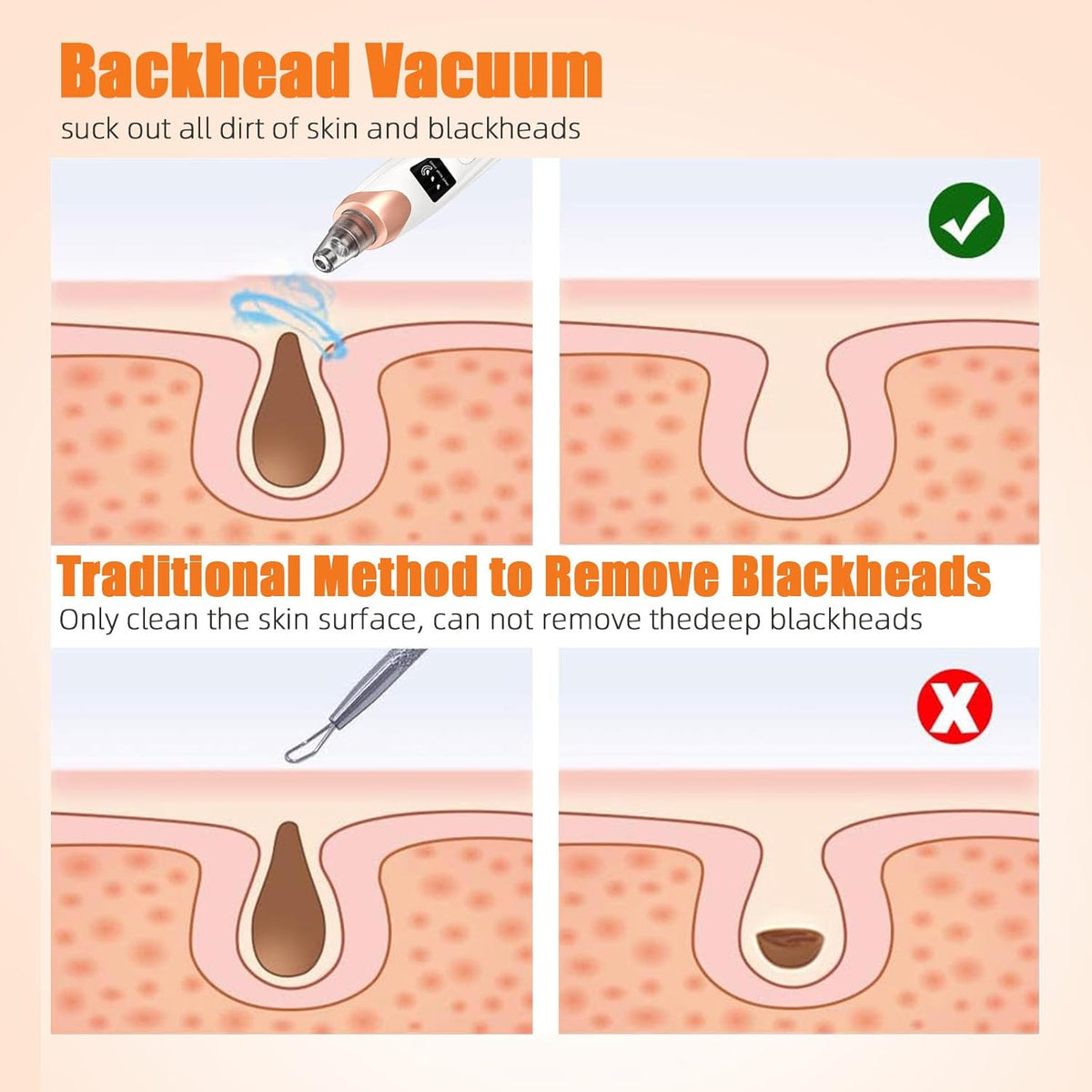 2025 Pore Vacuum, USB Rechargeable Blackhead Remover Vacuum,3 Levels Adjustable Pore Vacuum Blackhead Remover, with 5 Suction Power,6 Probes,Face Vacuum Pore Cleanser for Women & Men-White