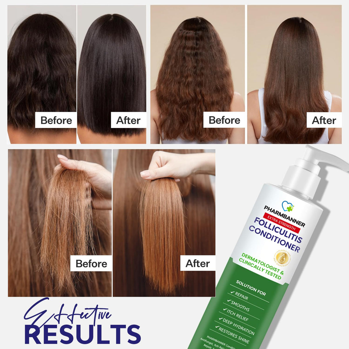 Folliculitis Itch Relief Conditioner: Tea Tree Oil & Moroccan Argan Oil - Deep Hydration & Repair - Nourishes, Smooths, Restores Shine - Safe for Dry or Damaged Hair-11.84 oz