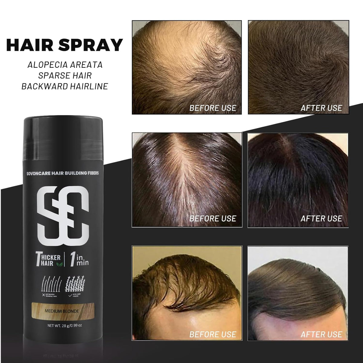SOVONCARE Hair Fibers for Thinning Hair Medium Blonde, Hair Building Fibers for Bald Spots Undetectable & Natural Conceals Hair Loss Fill In Fine Hair Powder Hair Thicker Instantly for Women & Men 28g