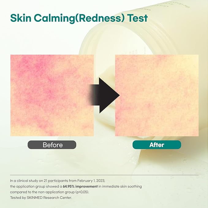 Calming Repair Cica Spot Pad, Centella, Madecassoside, 60 Pads