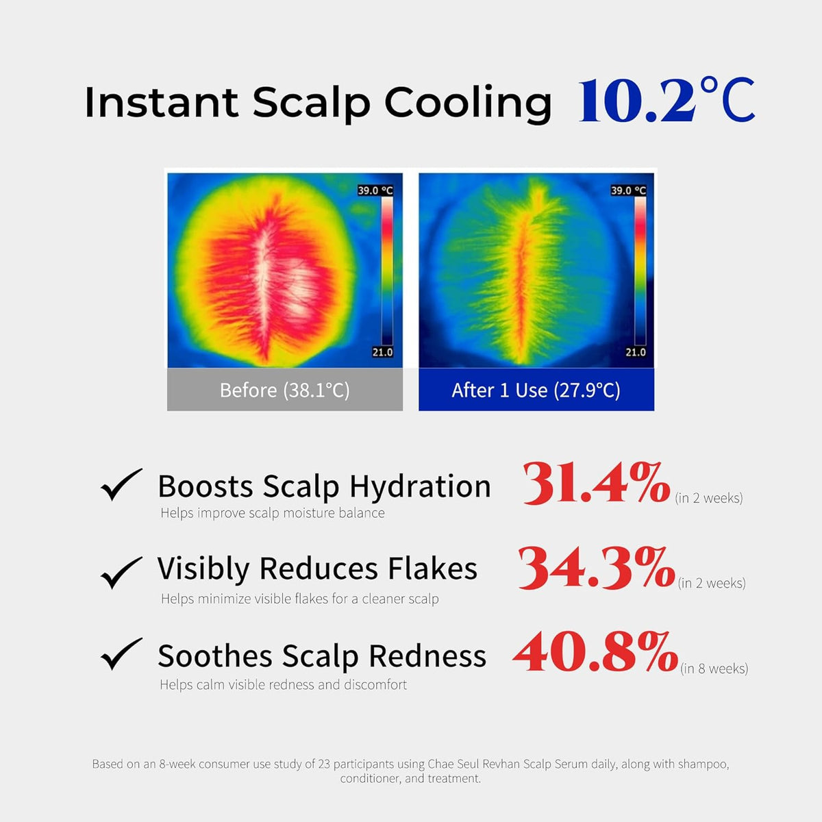 Revhan Scalp Serum for Hair Loss & Thinning – Hair Growth Serum for Men & Women w/Salicylic Acid & Centella Asiatica – Soothes Itchy, Irritated Scalp with Roll-On