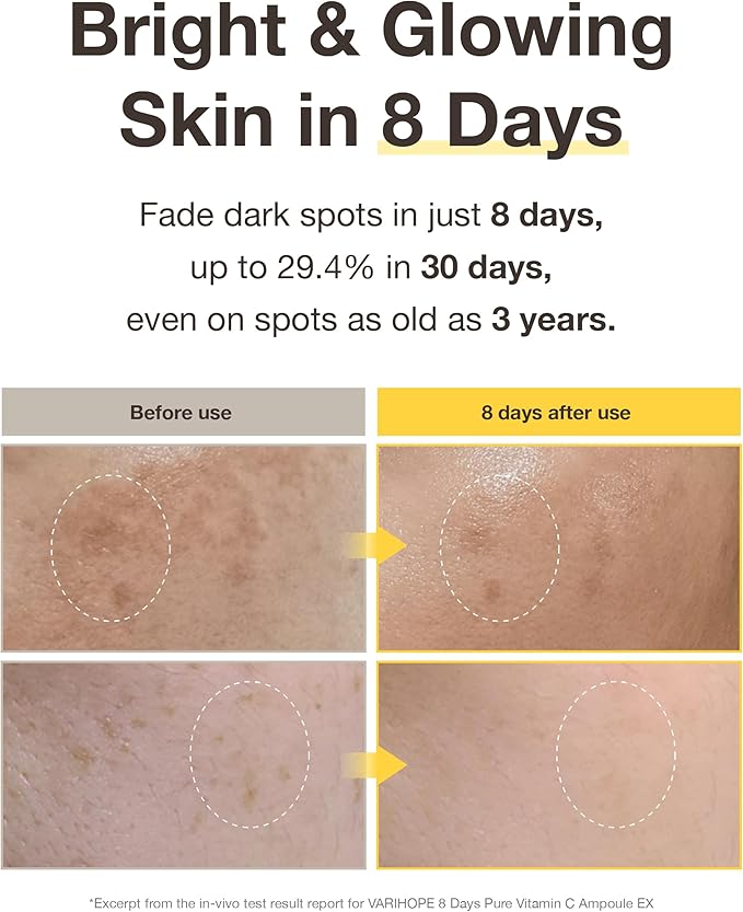 VARIHOPE 8 Days Pure Vitamin C Toner (3.5oz) - Hydrating, Mildly Acidic, Soothing Toner. Korean Skin Care. Stabilized Vitamin C, Kakadu Plum, Beta-Glucan.