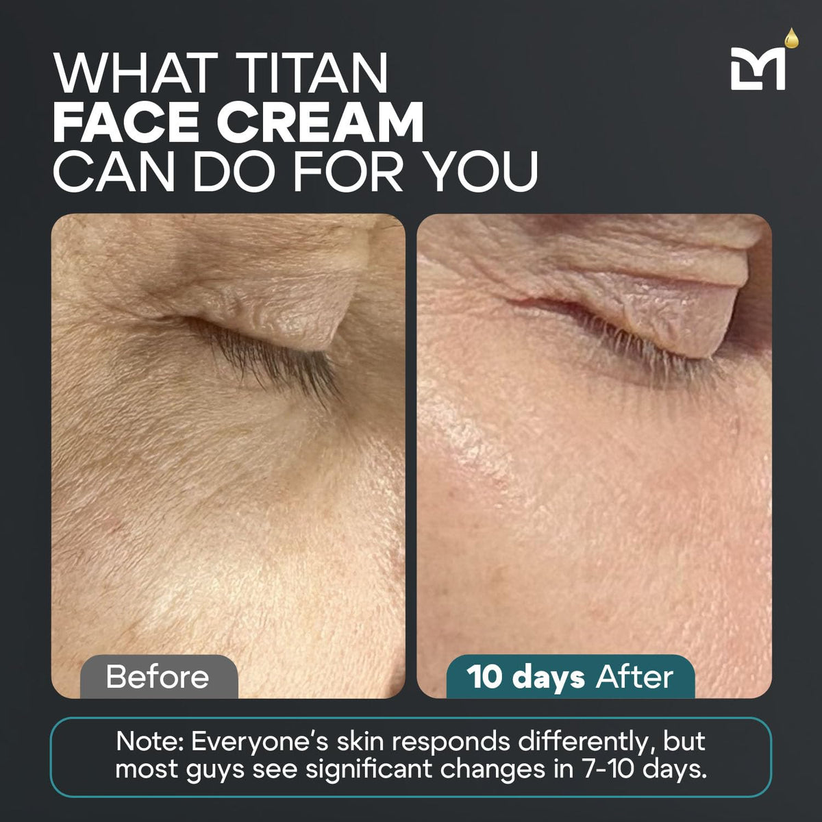 Titan Anti-Aging Mens Face Cream – Mens Face Moisturizer – For Men, Face Lotion – Men, Skin Care – Tighten, Tone, Revitalize – Ceramides, Vitamin C & E, Squalane – All Skin Types – Unscented