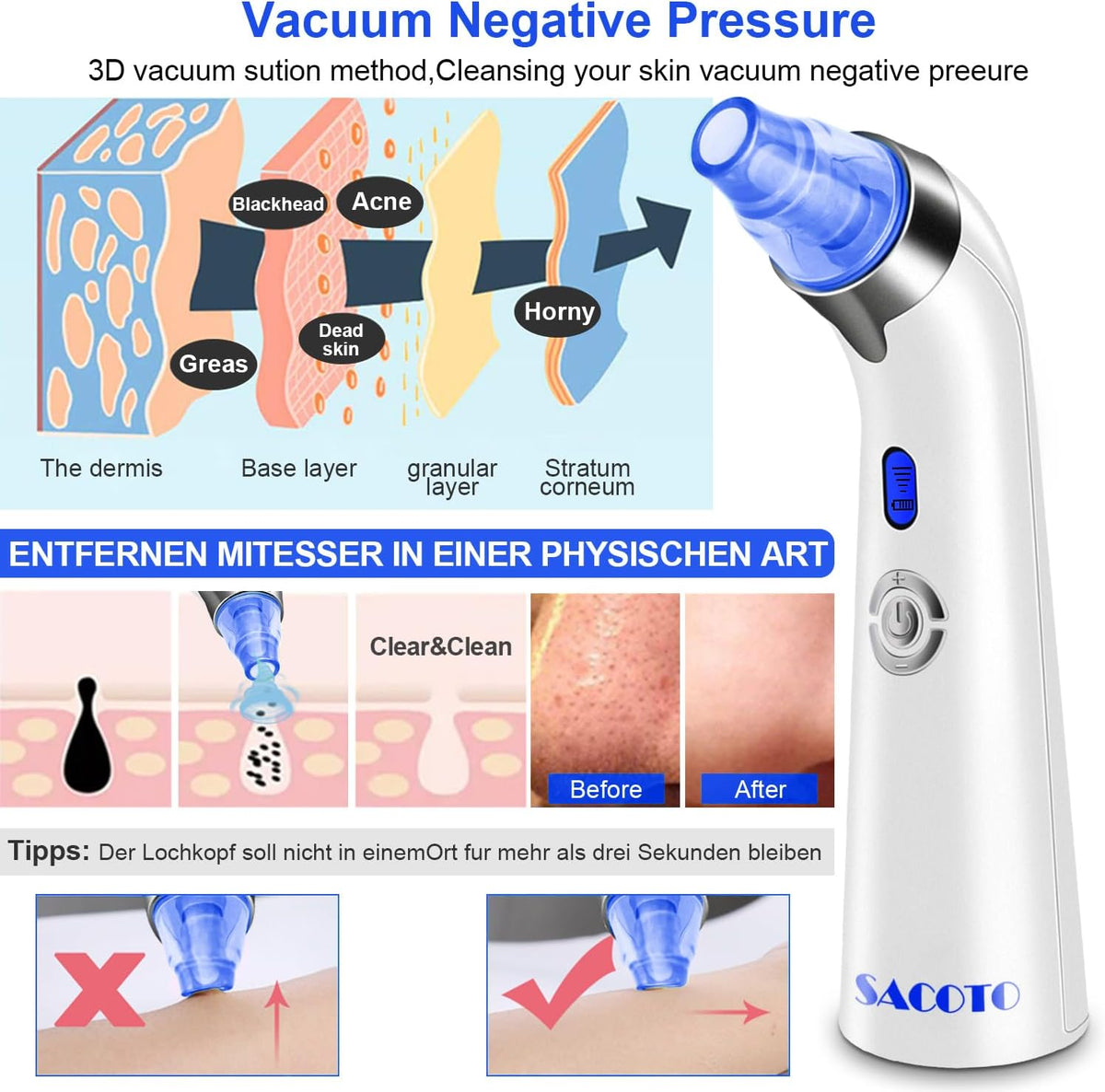 Blackhead Remover Pore Vacuum, Face Suction Pore Cleaner, 5 Suction Power Electric Blackhead Extractor Tool, 4 Probes, Blackhead Suction Remover for Women & Men（Blue）