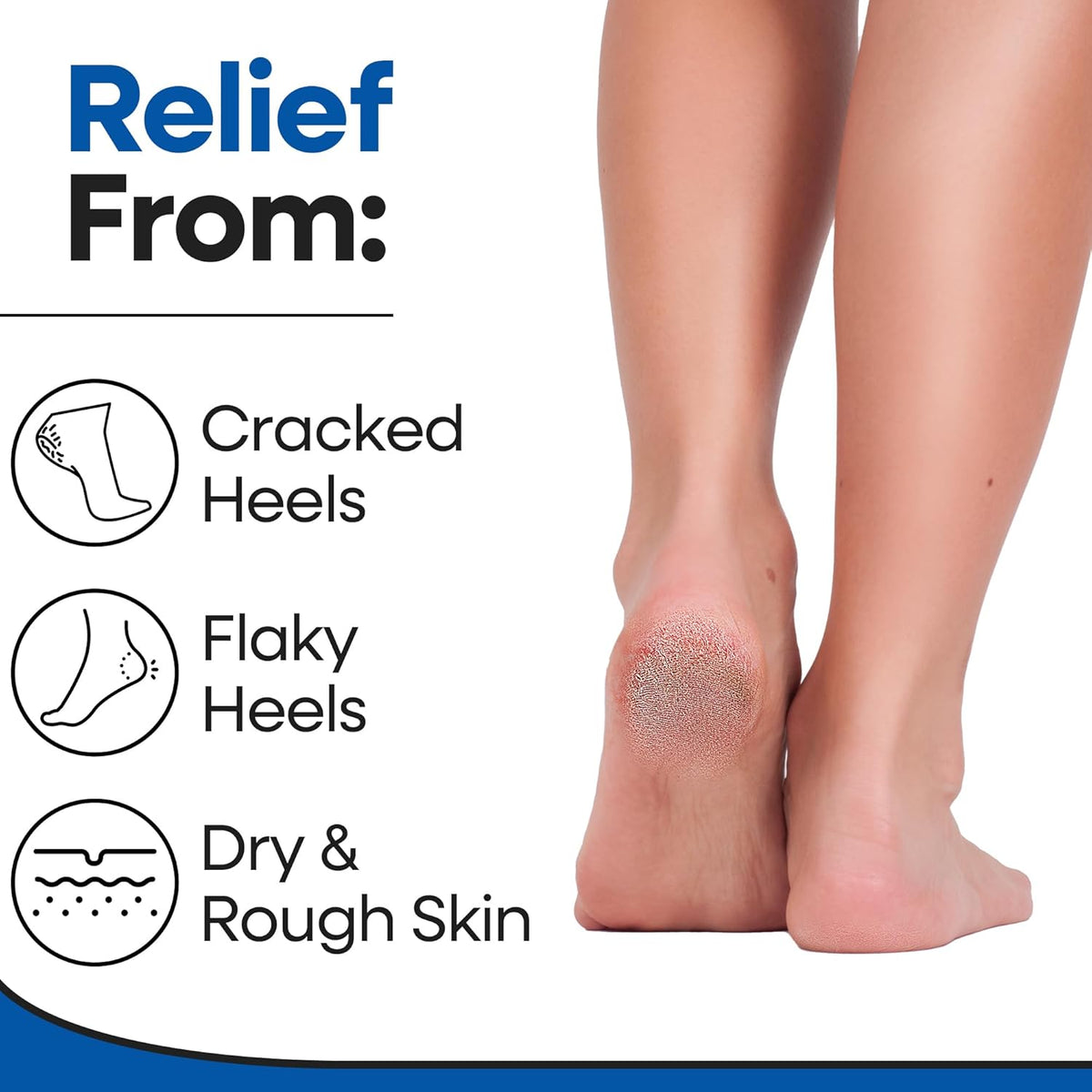 Moisturizing Socks | Cracked Heel Treatment with Aloe Vera | Moisturizer Foot Callus Remover | Aloe Socks for Cracked Heels & Dry Cracked Feet | Lotion Infused Gel Heel Socks (Fits Most)