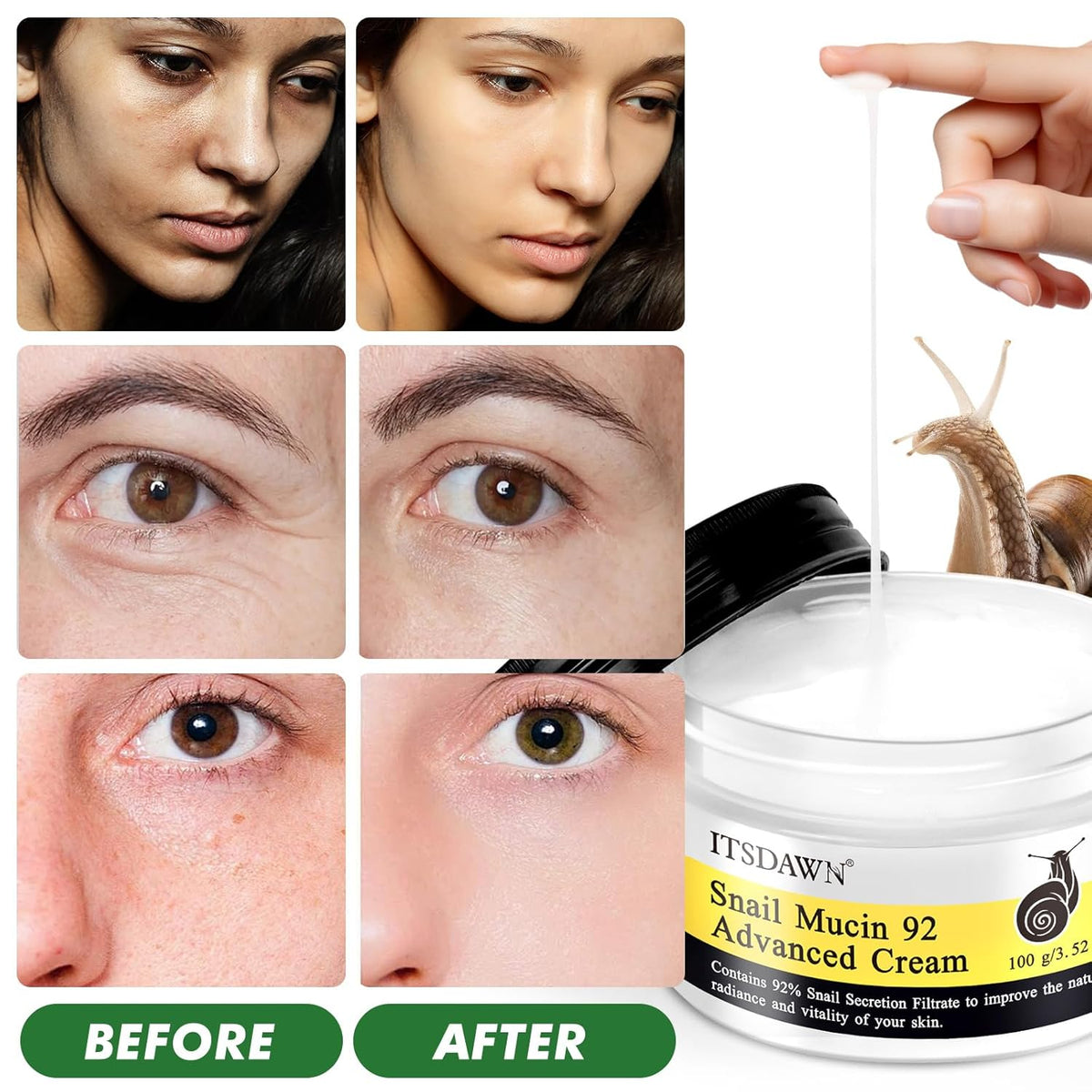 2 Pack Snail Mucin 92% Face Cream 100g, Moisturizer Hydrating Cream for Dry & Sensitive Skin, All Skin Types