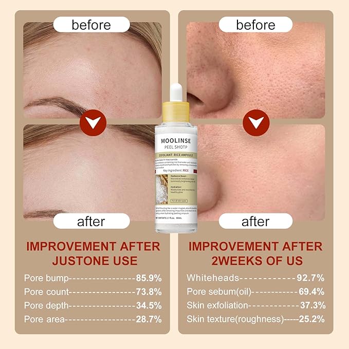 Peel Shot Glow Black and White Rice Peeling Ampoule, Soft Exfoliating Face and Body Scrub Dead Skin Cells Remover,Gentle Peel & Deep Hydration for All Skin Types (White+Black)