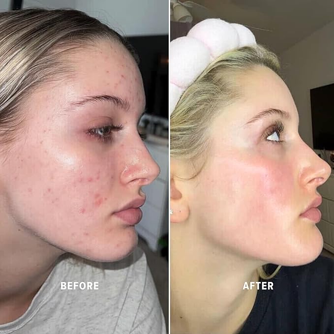 Kay’s Glow Serum + Infinite Aura Moisturizer + Boho Cleansing Balm – Oxygen-Infused THDA Vitamin C with Gentle AHA for Face and neck | Hydrates, Soothes and Brightens Bundle