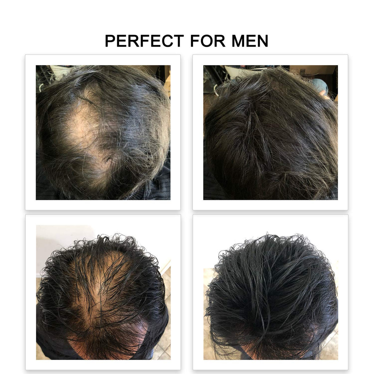 FEBRON Hair Fibers For Thinning Hair WHITE For Women & Men Hair Loss Concealer Hair Powder Volumizing Based 100% Undetectable & Natural - Bald Spots Filler (30 Gram, White)