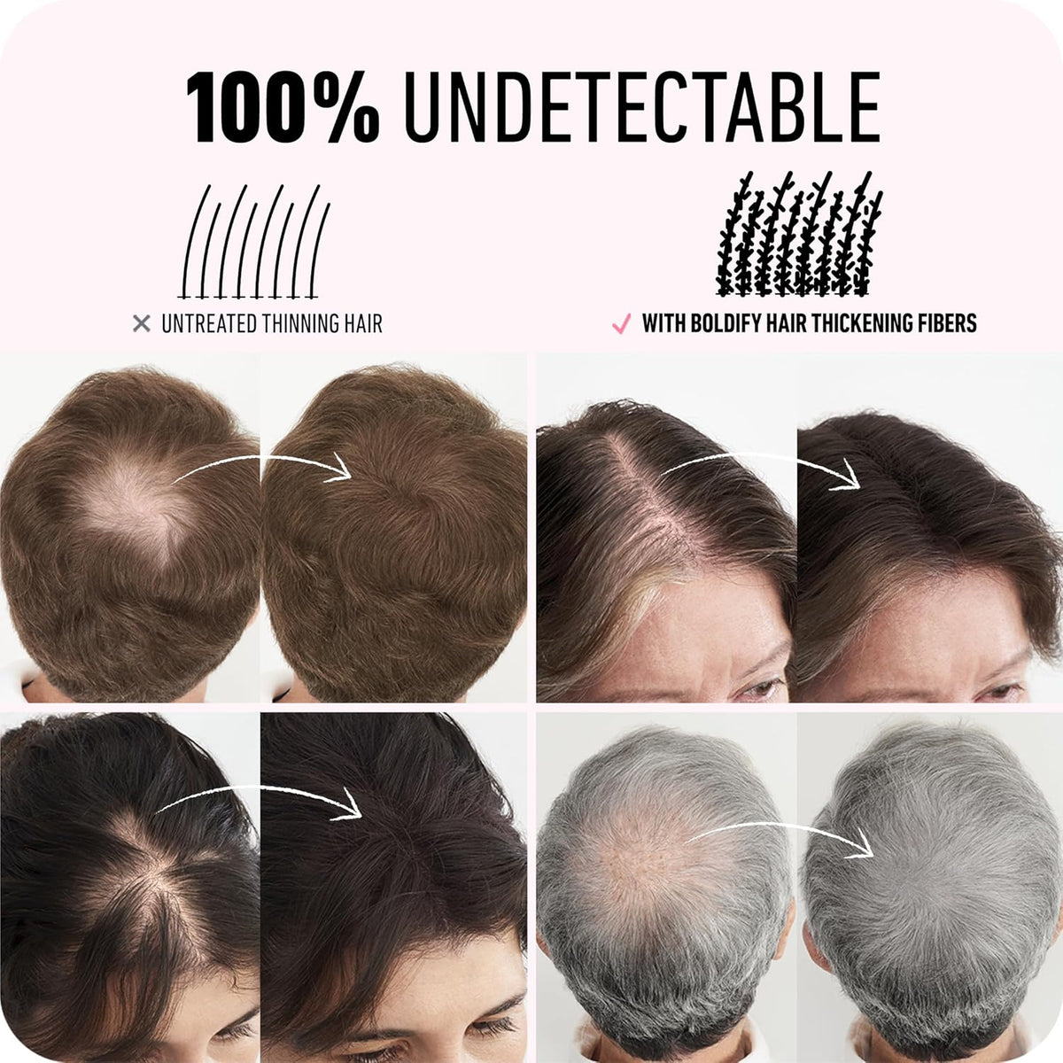 BOLDIFY Hair Fibers (28g) - Fill In Thinning and Fine Hair for an Instantly Fuller, Thicker Look - 14 Shades for Women & Men - White