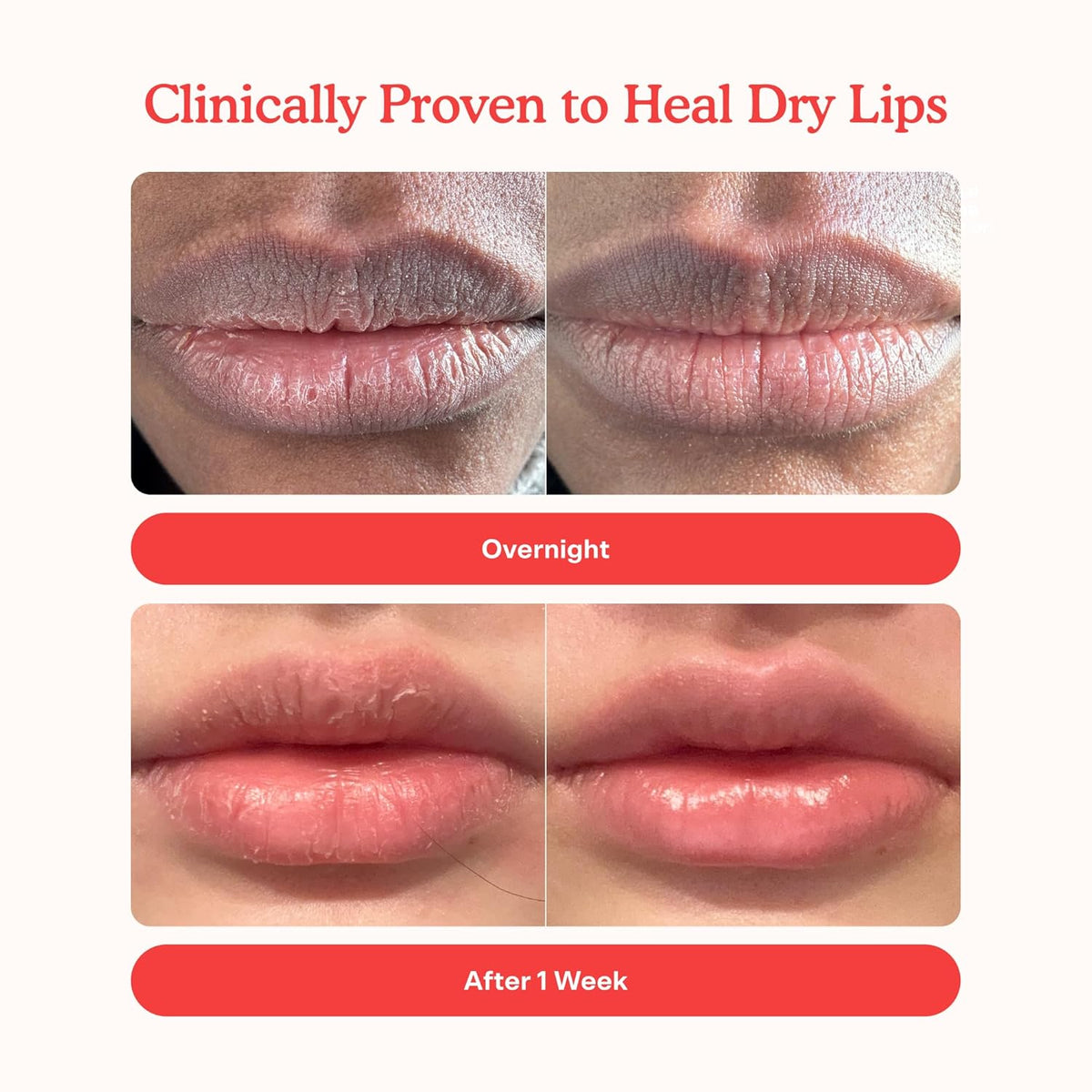 Tower 28 LipSoftie Hydrating Tinted Lip Treatment Balm, Moisturizing Lip Mask for Chapped Lips - Watermelon Kiwi Flavor, Sheer Baby Pink Gloss