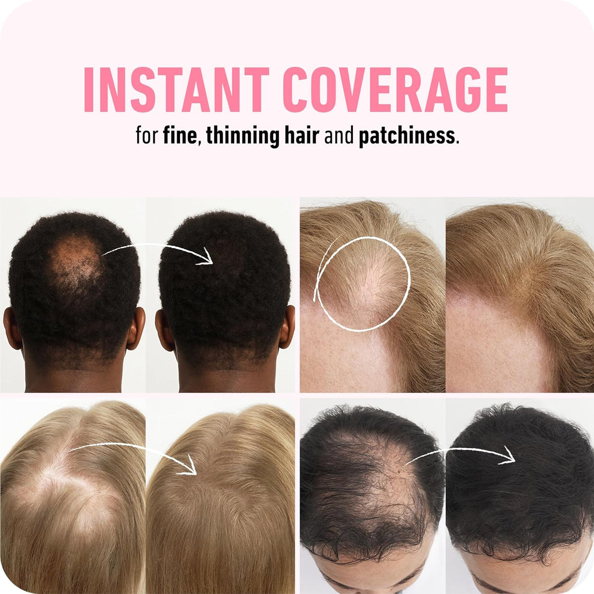 BOLDIFY Hair Fibers (28g) - Fill In Thinning and Fine Hair for an Instantly Fuller, Thicker Look - 14 Shades for Women & Men - Black