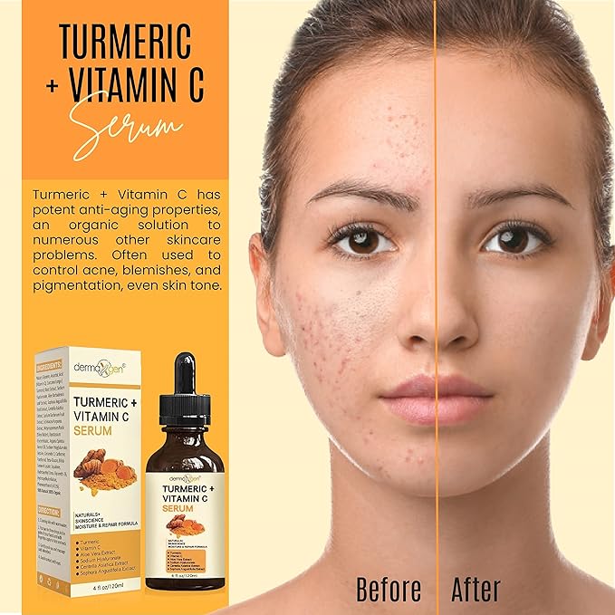 Turmeric Serum for Face + Glow-Boosting Vitamin C Serum –Organic Moisturizer for Acne, Dark Spots & Clear Skin– Boosts Hydration for Dry & Tired Skin – Anti-Aging Formula for Glowing Skin, 4 FL OZ