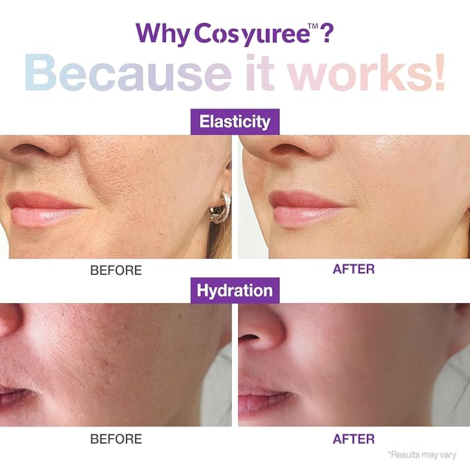 Spicule Collagen Serum | 120,000 Micro Spicules for Glass Skin, Wrinkle Treatment & Hydration | Hyaluronic Acid Anti-Aging Serum (1.69 fl.oz.)