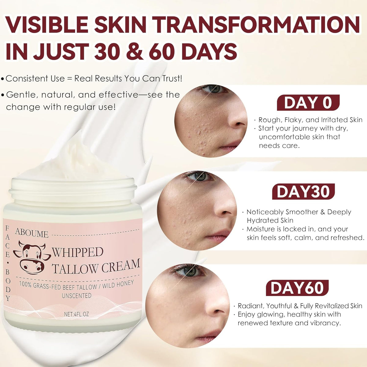 Beef Tallow for Skin, 100% Grass-Fed Whipped Beef Tallow and Honey Balm with Wild Honey & Beeswax, Face & Body Moisturizer Cream for Sensitive Skin 4 FL.OZ