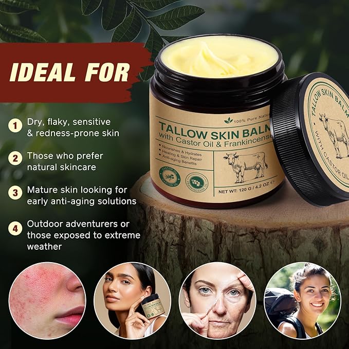 Tallow Skin Balm With Castor Oil & Frankincense, Vitality Frankincense Balms 100% Grass-Fed Tallows For Skin Care Castor Oil Balm Beef Tallow For Face & Body120 G/4.2 Oz