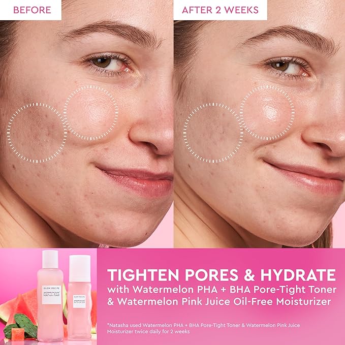 Glow Recipe PHA + BHA Face Toner - Korean Skin Care Pore Minimizer & Gentle Facial Exfoliator for Tightening, Hydrating & Exfoliating - Glycerin, Watermelon & Cactus Water (150ml)